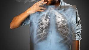 El 90% de casos de Cáncer de Pulmón están relacionados con el tabaquismo: Salud Sonora
