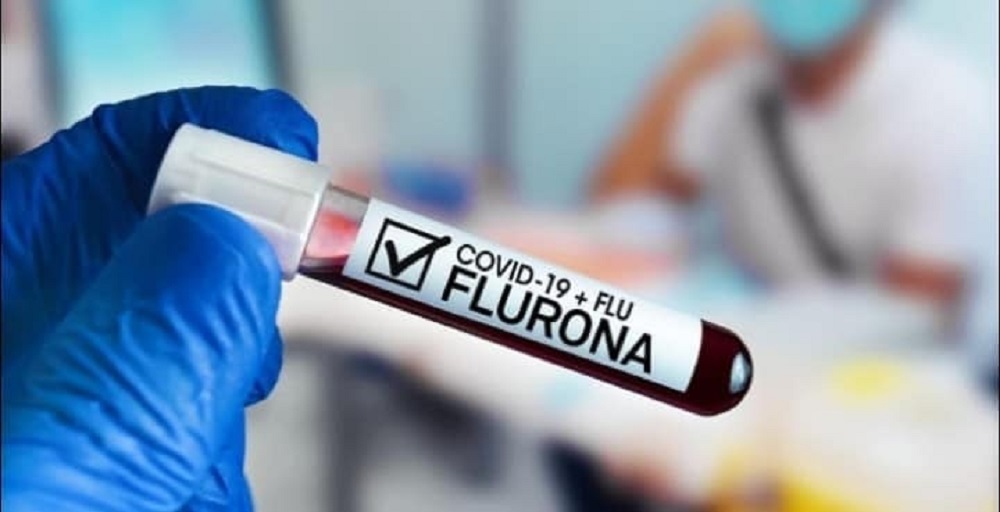 Confirman primer caso de flurona en México en una mujer de Tepic, Nayarit