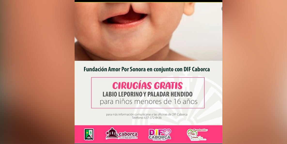 Realizarán cirugías gratis para niños con labio leporino y paladar hendido en Caborca