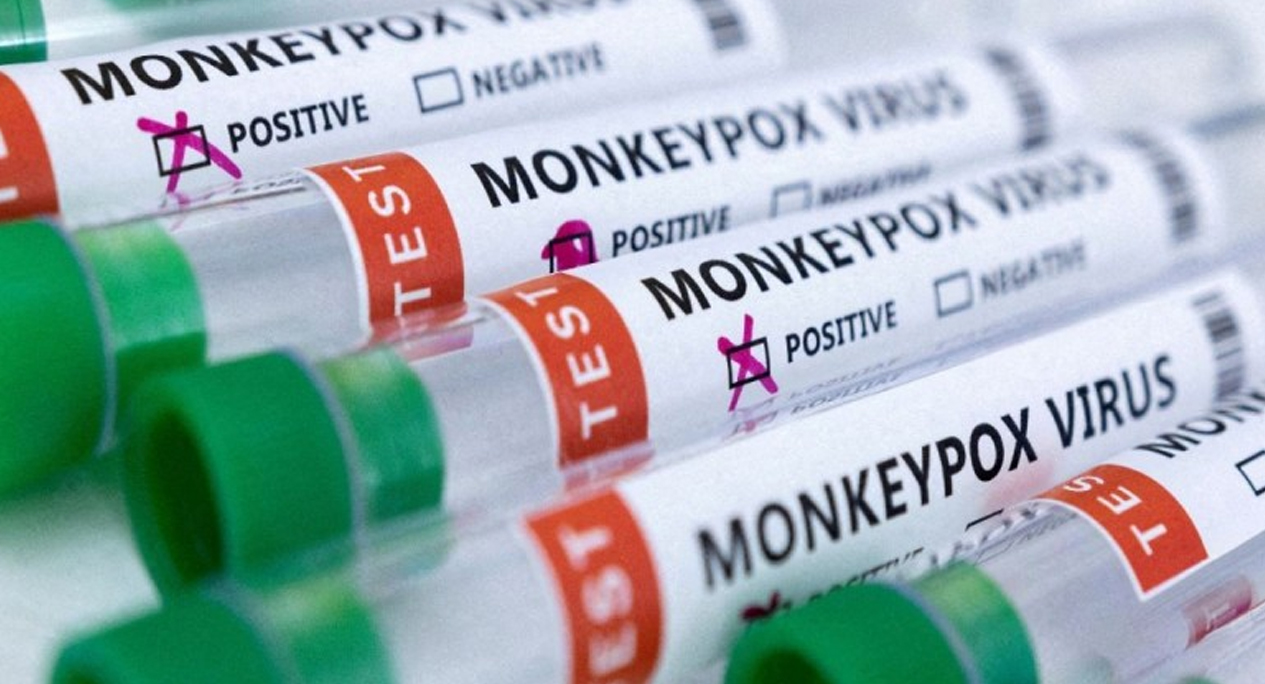 China reporta su primer caso de viruela del mono