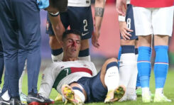 El violento golpe a Cristiano Ronaldo que asustó a todos en República Checa-Portugal
