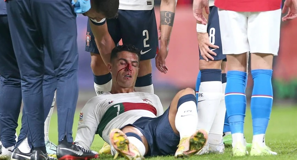 El violento golpe a Cristiano Ronaldo que asustó a todos en República Checa-Portugal