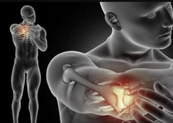 Tlaxcala emite alerta epidemiológica por el incremento del síndrome Guillain Barré