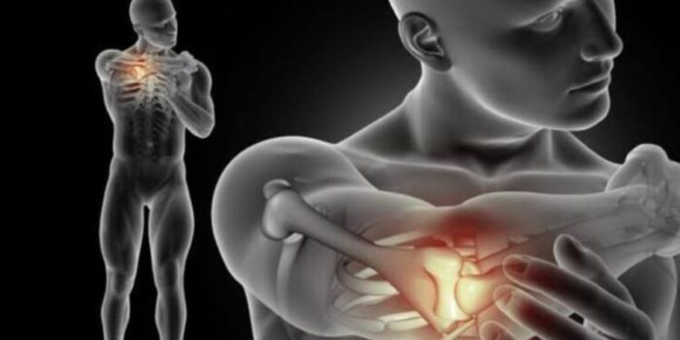 Tlaxcala emite alerta epidemiológica por el incremento del síndrome Guillain Barré
