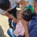 México emite nuevo aviso epidemiológico por sarampión