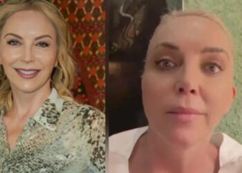 Laura Flores sufre un microinfarto cerebral por tratamiento estético