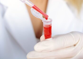 Llama Salud Sonora a detectar a tiempo la Hemofilia