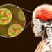 Salud Sonora exhorta a detectar oportunamente la meningitis