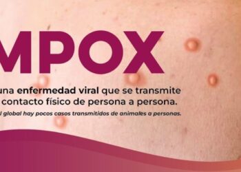 Salud Sonora atiende recomendaciones preventivas ante riesgos internacionales por Viruela del Mono (MPOX)