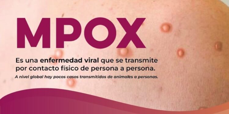 Salud Sonora atiende recomendaciones preventivas ante riesgos internacionales por Viruela del Mono (MPOX)