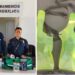 Más equipo para puesto de primeros auxilios en playa Miramar