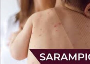 Sonora se mantiene sin casos autóctonos de sarampión