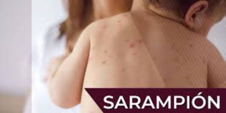 Sonora se mantiene sin casos autóctonos de sarampión