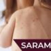 Sonora se mantiene sin casos autóctonos de sarampión