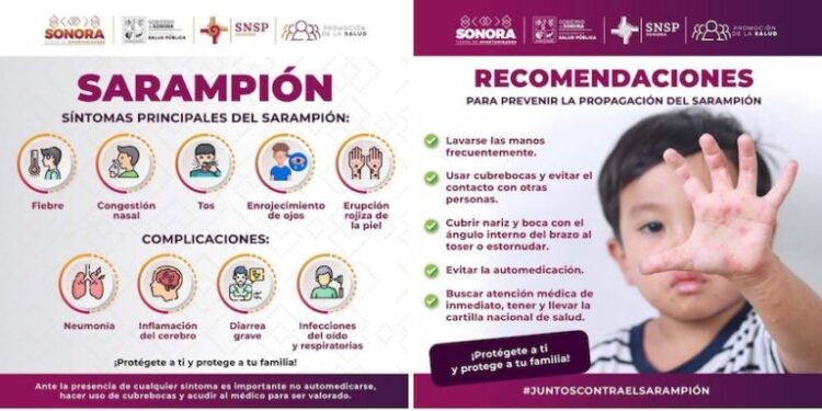 La vacunación es clave para prevenir el sarampión