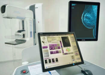 En México, una mujer muere cada hora por cáncer de mama: Salud