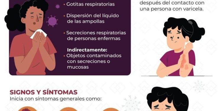 Salud Sonora comparte consejos prácticos para evitar la varicela