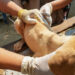 Refuerzan acciones preventivas contra la Rickettsia
